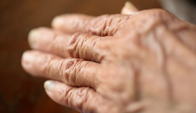 a kezek rheumatoid arthritis tünetei nőkben)